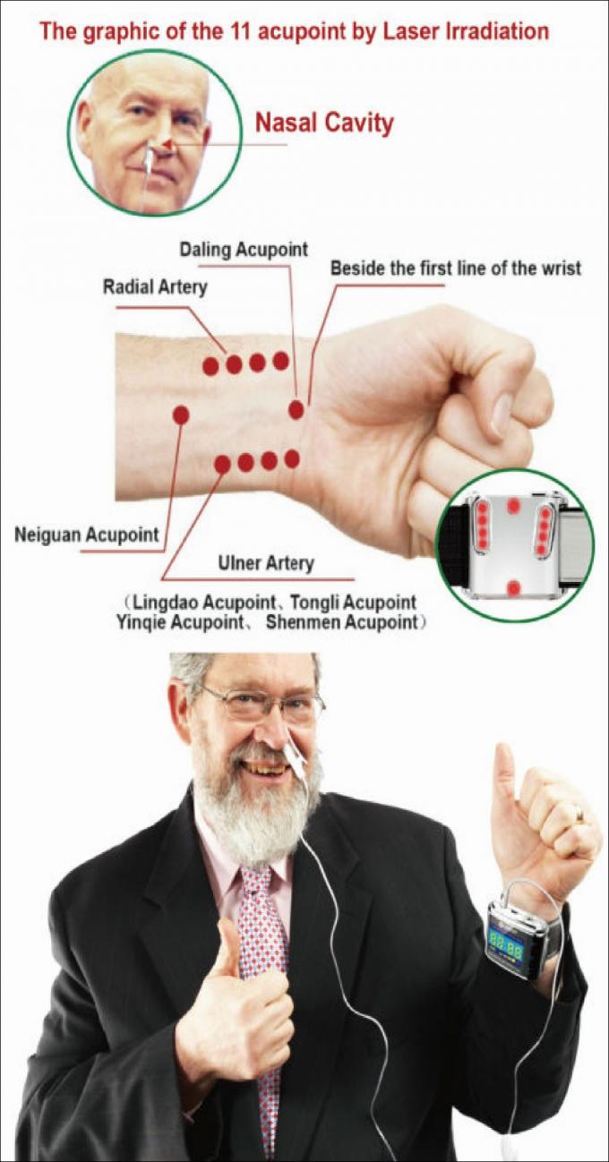 Laser Hemoterapi Viskositas Gula Darah Tinggi, Kolesterol, Terapi Level Bawah, Laser Watch