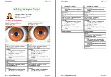 Analisis Iris Digital Terbaru Kamera Digital Usb Alu Case Resolusi Tinggi