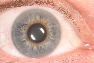 Portable CE Handheld Eye Iris Scanner Analyzer Untuk Mendeteksi Kesehatan