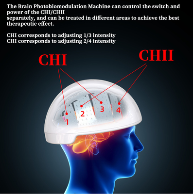 Terapi Rtms Helm Otak Transkranial Magnetic Stimulator Photobiomodulation
