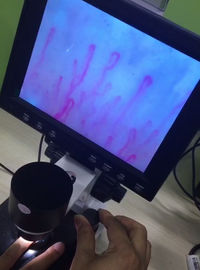 Mikrosirkulasi Generasi Selanjutnya, Mikroskop Pembuluh Darah Untuk Kesehatan