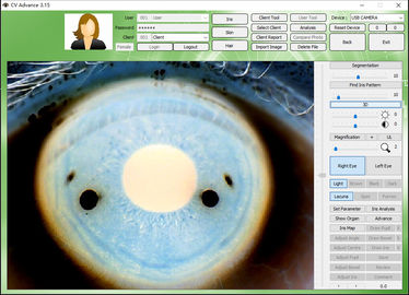 12.0MP Digital Iriscope Iridology Kamera Eye Testing Machine Persetujuan CE / DHL