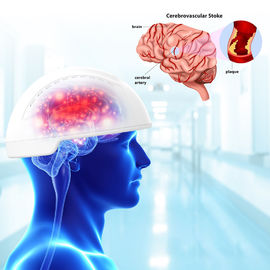 Perangkat Cedera Otak Traumatis Perangkat Photobiomodulasi Otak Panjang Gelombang 810nm