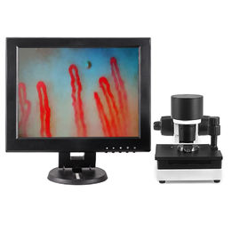 Mikrosirkulasi Darah Kapiler Mikroskop 600X Pembesaran DC12V 2A Output