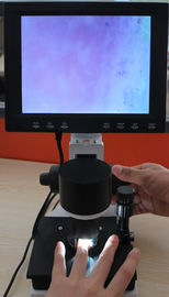 Peralatan Mikrosirkulasi Warna Nailfold Capillary Microscope 380000 piksel dengan CE