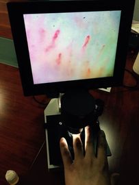CE Disetujui OEM Layar LCD Mikroskop Sirkulasi Warna untuk Memeriksa Kuku