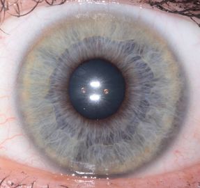 Portable CE Handheld Eye Iris Scanner Analyzer Untuk Mendeteksi Kesehatan