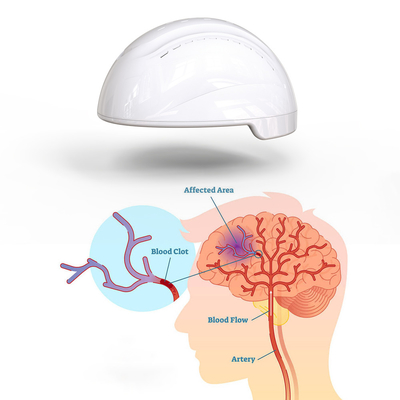 Perangkat Neurofeedback Stimulasi Magnetik Transkranial Stroke Inframerah 810nm