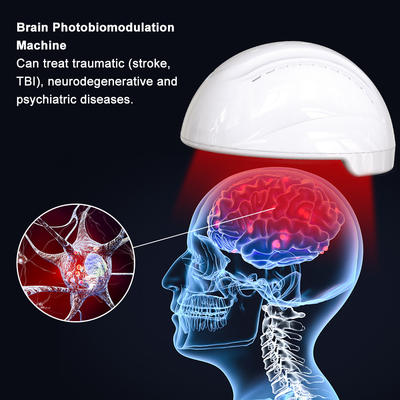 Helm Fotobiomodulasi Terapi Cahaya untuk kejadian traumatis (stroke, cedera otak traumatis, dan iskemia global)